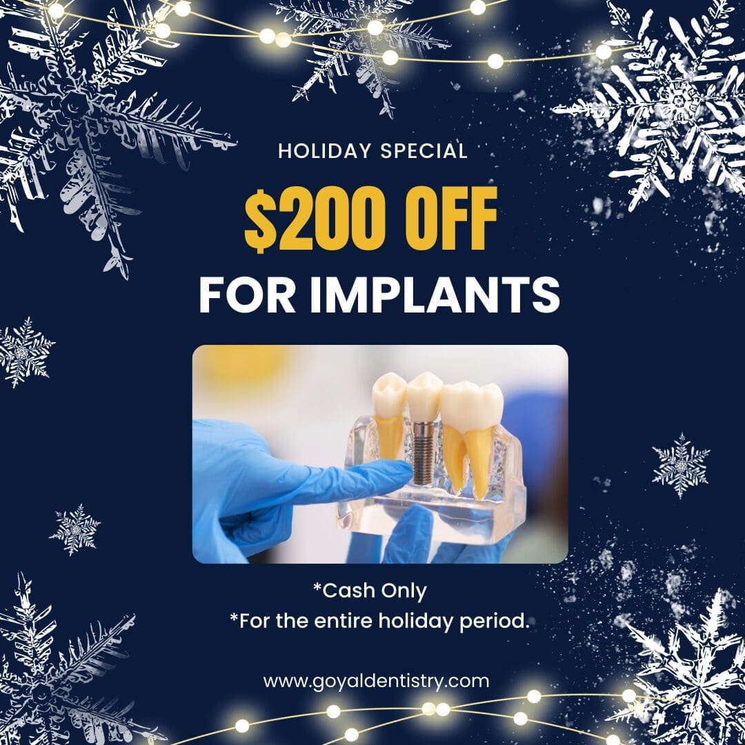 Holiday Special - Implant