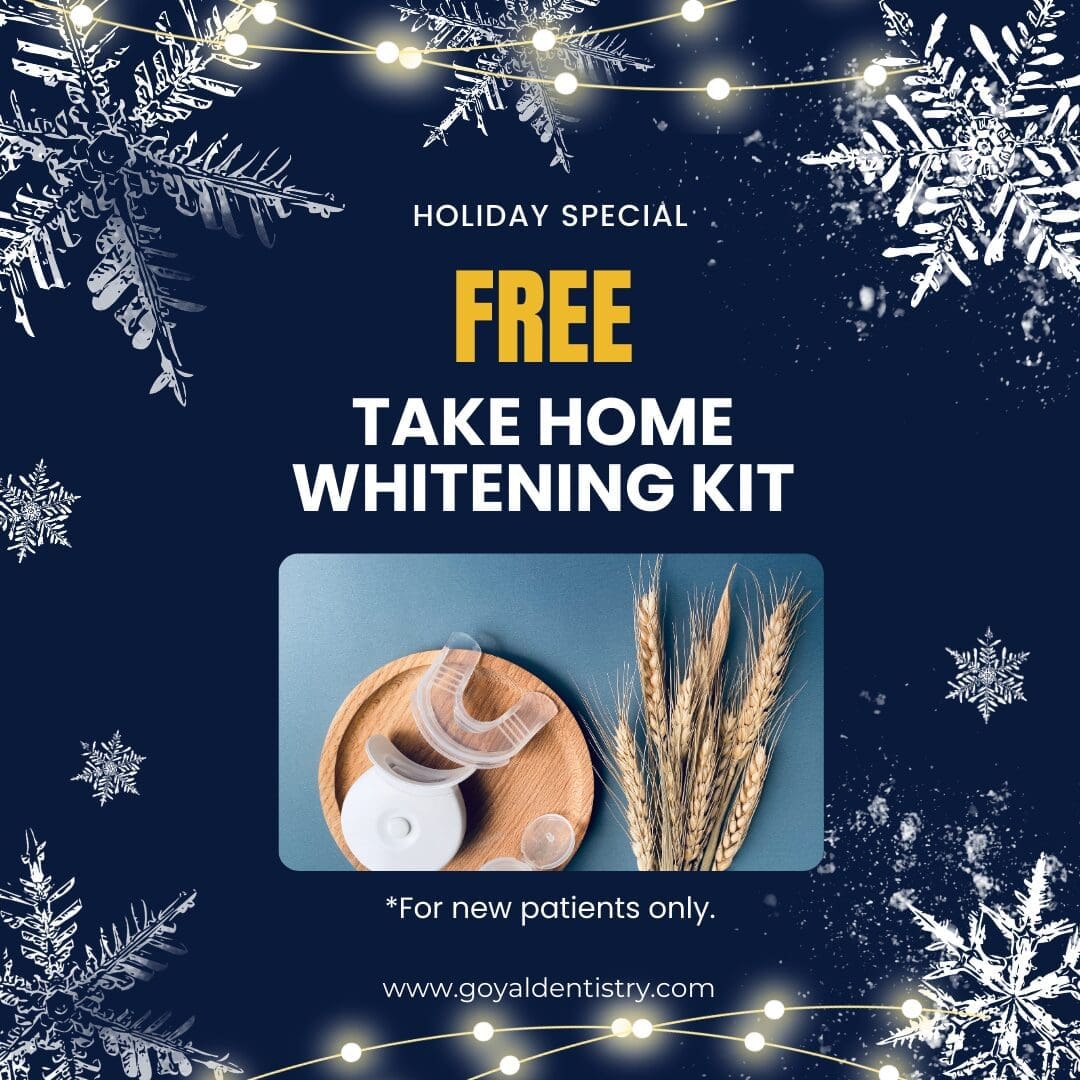 Holiday Special - Whitening Kit